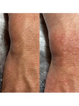 サロン ド ソレイユ(Salon.de.Soleil)/