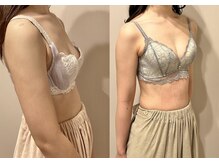 ティアモ(Ti Amo)/Before/After(9回目)