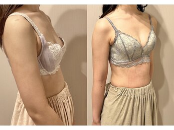 ティアモ(Ti Amo)/Before/After(9回目)