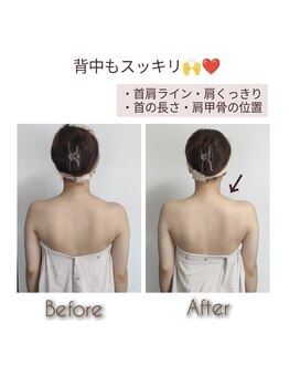 ミードット(me.)/背中もスッキリ華奢に☆