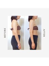 ルーチェビューティープラス(LUCE' beauty +)/肩甲骨剥がし