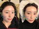 アム(aM)の写真/お顔のむくみ・フェイスラインのもたつきが気になる。そんな方はぜひ"aMの美容鍼"をご体感ください。