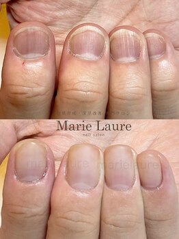 マリーロール 淀屋橋本店(Marie Laure)/深爪矯正/自爪育成/ネイルケア