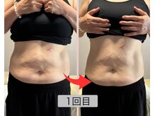 リセル(Recell)/お腹★脂肪分解