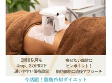 サロンアオバ 稲毛店(salon Aoba)の雰囲気(今話題の脂肪冷却ダイエット)
