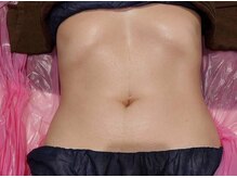 ワララ(Wala'la)の雰囲気（痩身後のウエスト）