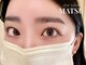 マツ(MATSU)の写真