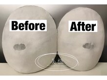 美極 銀座店/銀座/小顔コルギ/小顔矯正