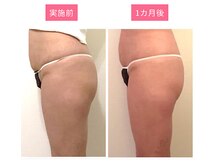 プレミアムマッサージサロン 自由が丘店(premium massage salon)/ビジリス・美尻イス