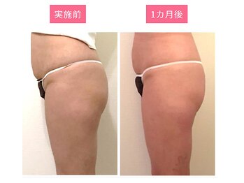 プレミアムマッサージサロン 自由が丘店(premium massage salon)/ビジリス・美尻イス