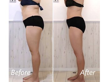 ドクターボディ 新宿店(Dr.Body)/【痩身】体調改善&ダイエット