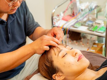 なごみや/カオノハリ（美容鍼）