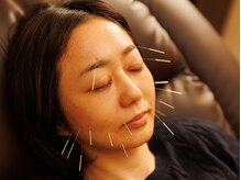 光幸はりきゅう院接骨院/肌荒れ解決・ニキビケア☆浦和