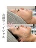 【35歳以上限定☆モニター様募集中！】3D小顔フェイシャル