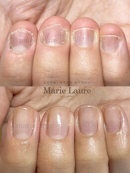 マリーロール 淀屋橋本店(Marie Laure)/自爪育成/深爪矯正/ネイルケア
