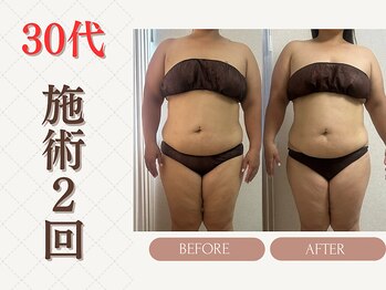 ミヨンビー(miyong.B)/痩身mom管理90分コース