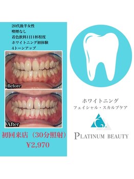 プラチナムビューティ 渋谷店(PLATINUM Beauty)/セルフホワイトニング
