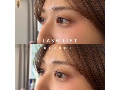 ブルームエイト(Bloom8)の写真