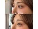ブルームエイト(Bloom8)の写真