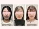 シー 下北沢(sea)の写真/《喜びの声続々》骨格/筋肉/筋膜/リンパから整える本格小顔矯正◆バランス調整&血液循環促進でお悩み解消！
