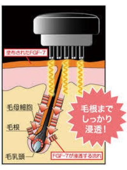 ラニズ(Lani's Hawaiian Relaxation)/頭皮のケア