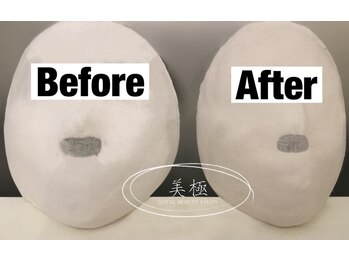 美極 銀座店/銀座/小顔コルギ/小顔矯正