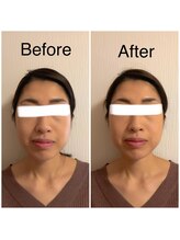 カイロプラクティック ネクサス/顔の歪み撃退☆