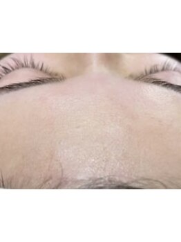 毛穴ケアをしたい