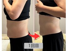 リセル(Recell)/お腹★脂肪分解