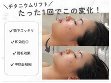 ノイ(Noi)/¥栃木県発/チタニウムリフト