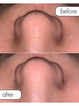 サロン ド カスケード(Salon de Cascade)/20代男性