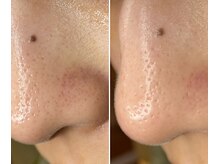 サイ(Sai)/before⇒after