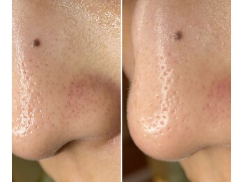 サイ(Sai)/before⇒after