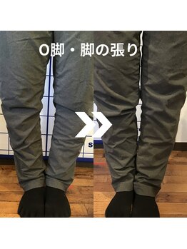 からだサロン サニー 堺東(SUNNY)/O脚・足の張り
