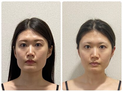 シエル(CIEL)の写真