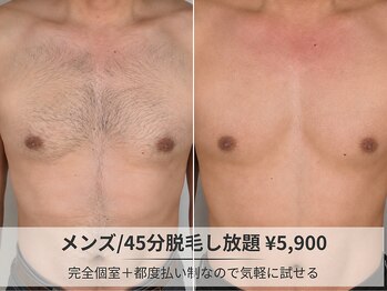 フルーブラン(Frubran)/【メンズ脱毛】45分打ち放題