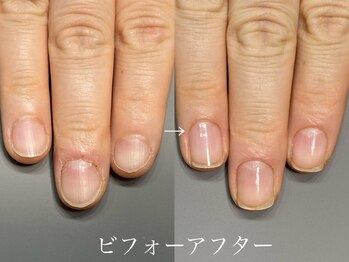 オープンセサミ 練馬/3ヵ月集中地爪育成コース/全8回