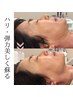 【モニター様】全方位から整える最強小顔術☆¥24,900→¥12,900