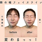 ピオニービューティー(Peony Beauty)