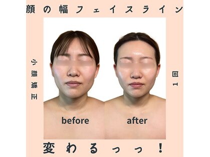 ピオニービューティー(Peony Beauty)の写真