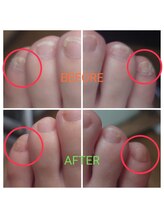 アンティ(Aunty)/小爪（副爪）