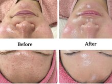 ゆらり/艶肌ケア