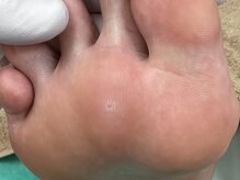 ディオフット(DIO FOOT)