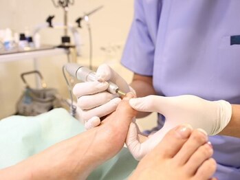 巻き爪補正店　小倉店の写真/【小倉】巻き爪・厚い爪・魚の目など足のお悩みを根本改善！巻き爪補正1箇所5,500円～◎