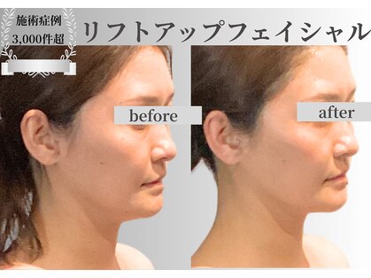 ノーブルノアール(Noble noir)の写真