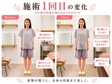 天空の手もみの雰囲気（美脚矯正とフットリンパマッサージでむくまない美脚へ(O脚矯正)）