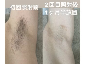 テンパ ビューティー(+10%beauty)/効果写真