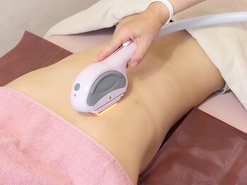 ジェリートップ(Jelly Top)/