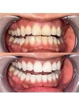 ライトビューティー 池袋店(LightBeauty)/症例写真