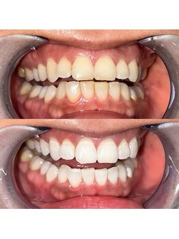 ライトビューティー 池袋店(LightBeauty)/症例写真